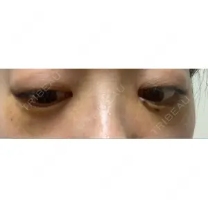 APOLLO BEAUTY CLINIC口コミ