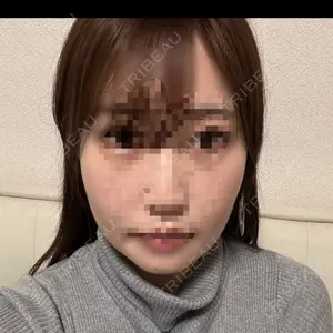 セギム美容整形外科口コミ