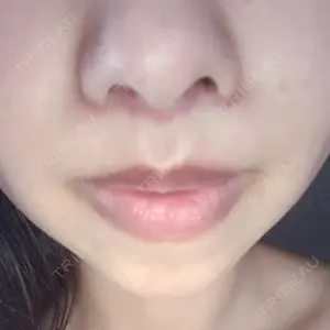 口コミ
