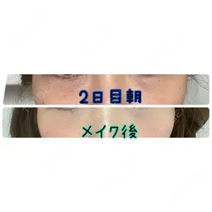 ギャラリークリニック ギャラリークリニック 銀座口コミ