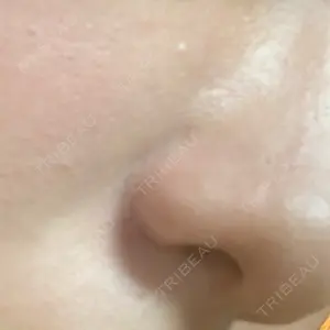 渋谷の森クリニック口コミ