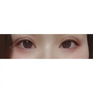 口コミ