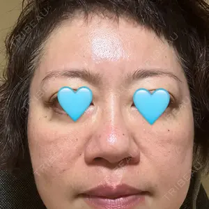 CHARIS BEAUTY CLINIC口コミ