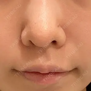 口コミ