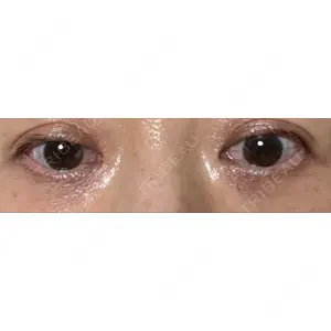 東京イセアクリニック口コミ