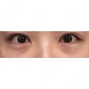 APOLLO BEAUTY CLINIC口コミ