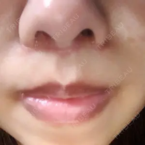 口コミ