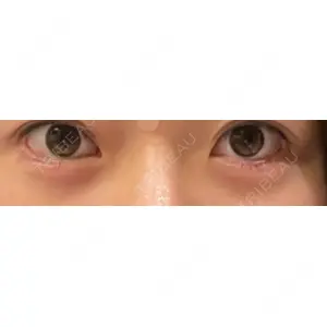 フィラークリニック フィラークリニック 町田院口コミ