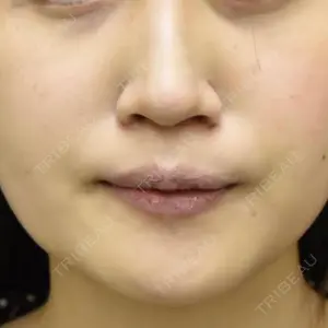 渋谷の森クリニック口コミ