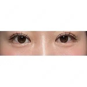 Olino美容外科・美容皮膚科口コミ