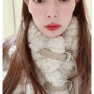 TCB東京中央美容外科 TCB東京中央美容外科 新宿東口院口コミ