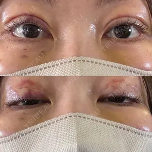 プロミス整形外科口コミ