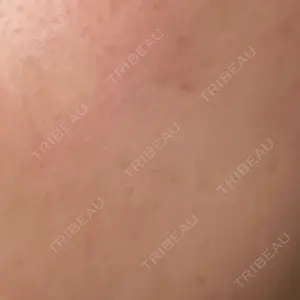 ARTE SKIN CLINIC 【アルテスキンクリニック】口コミ