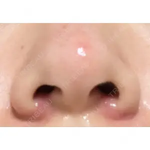 渋谷の森クリニック口コミ
