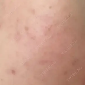 ARTE SKIN CLINIC 【アルテスキンクリニック】口コミ