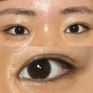 HAAB×DREAM BEAUTY CLINIC HAAB×DREAM BEAUTY CLINIC 大阪梅田院口コミ