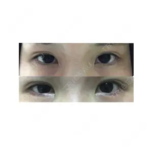 口コミ