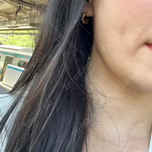 TCB東京中央美容外科 TCB東京中央美容外科 秋葉原院口コミ