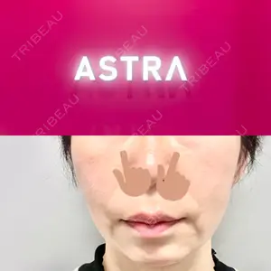 ASTRA BEAUTY CLINICの