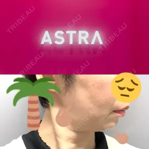 ASTRA BEAUTY CLINICの