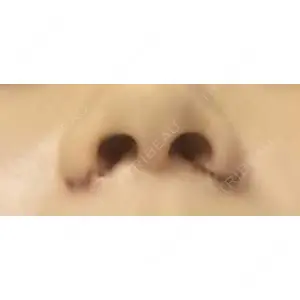 渋谷の森クリニック口コミ