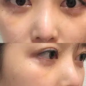 銀座みゆき通り美容外科 大阪梅田院の