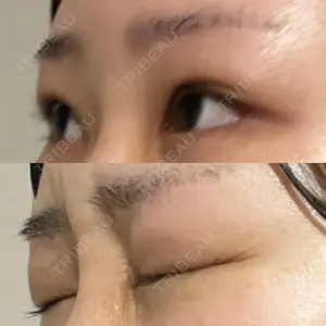 湘南美容クリニック 湘南美容クリニック 池袋東口院口コミ