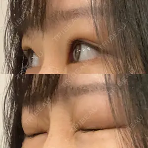 湘南美容クリニック 湘南美容クリニック 池袋東口院口コミ