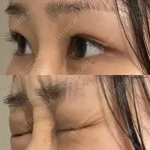 湘南美容クリニック 湘南美容クリニック 池袋東口院口コミ