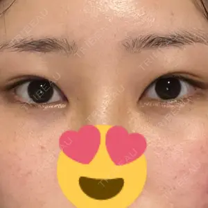 湘南美容クリニック 湘南美容クリニック 池袋東口院口コミ