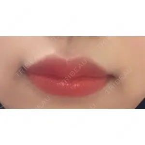 口コミ
