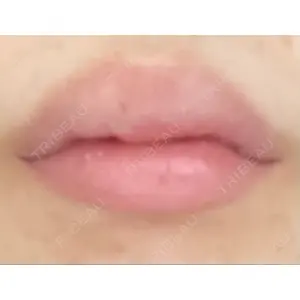 フィラークリニック フィラークリニック 町田院口コミ