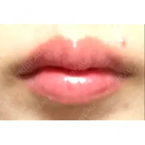 フィラークリニック フィラークリニック 町田院口コミ