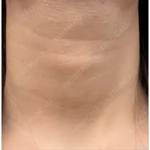 スマートスキンクリニック スマートスキンクリニック 神保町院口コミ