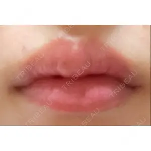 フィラークリニック フィラークリニック 町田院口コミ