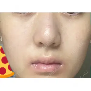 まゆりなclinic 名古屋栄口コミ