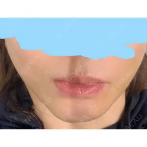 LETICIA CLINIC（レティシア クリニック）口コミ