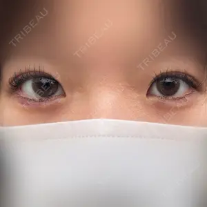 フィラークリニック フィラークリニック 札幌院口コミ