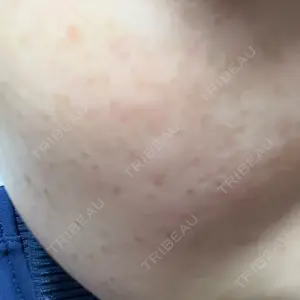 Fellez Clinic【フェルズクリニック】口コミ