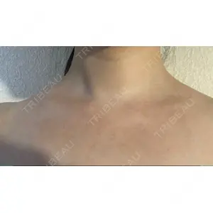 L‘amour clinic Tokyo【ラムールクリニック東京】口コミ