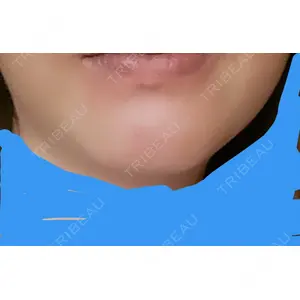 LETICIA CLINIC（レティシア クリニック）口コミ