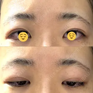 オアシス美容外科口コミ