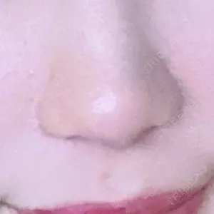 渋谷の森クリニック口コミ