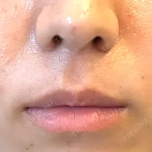 口コミ