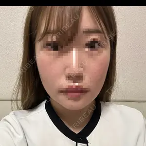 セギム美容整形外科口コミ
