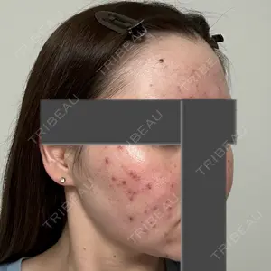 東京美容外科 東京美容外科 池袋院口コミ