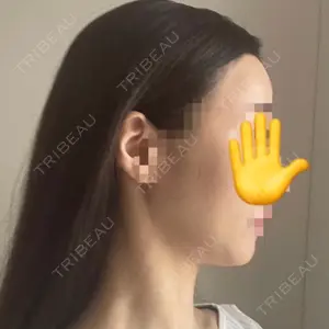 セギム美容整形外科口コミ