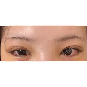 R Beauty CLINIC R Beauty CLINIC 銀座院口コミ