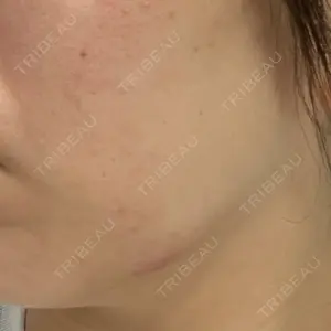 DMTC美容皮膚科 DMTC美容皮膚科 日本橋院口コミ