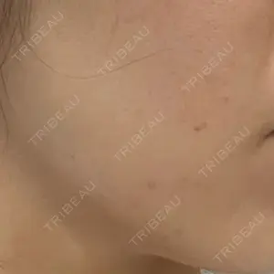 DMTC美容皮膚科 DMTC美容皮膚科 日本橋院口コミ